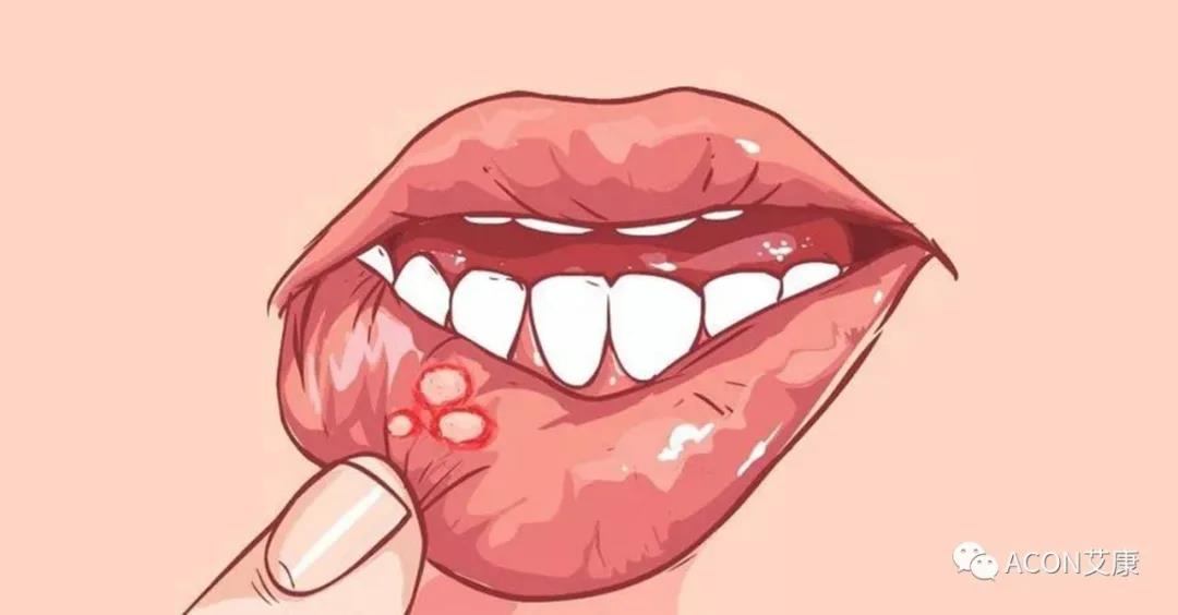 哪些小病容易讓人忽視，最后造成越拖越嚴重呢？