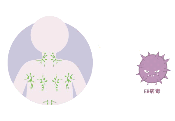 體檢查出“EB病毒”陽(yáng)性！一定就是鼻咽癌嗎？
