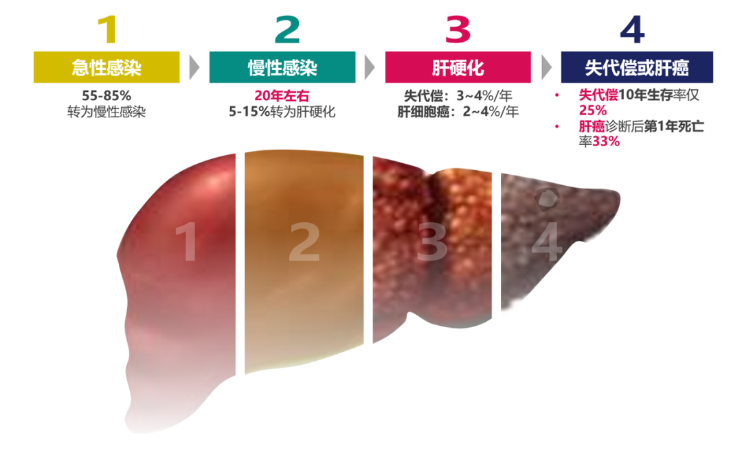 悄悄變成肝硬化、肝癌，很多人感染了卻不知道