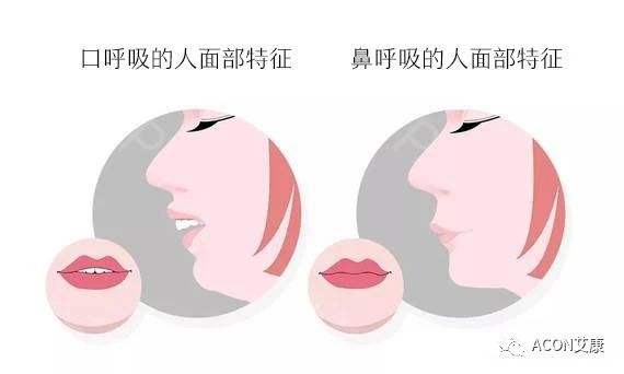 過敏性鼻炎會讓孩子變傻？！家長該如何應(yīng)對